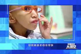 「独家」10岁女孩变成“小老人”，如今这一罕见遗传病已被成功阻断图片