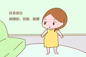 孕期水肿恐影响胎儿发育！如何分辨孕期是“胖”还是“肿”？图片