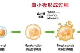 被发现100多年的血小板，竟是这些病的“帮凶”！难怪要体检检测图片