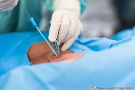 经中心静脉导管采血，能还是不能，为什么？图片