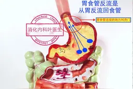 反酸、胃食管反流做胃镜能看确诊吗？医生3个问题一次性讲清楚图片