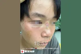 14岁男生遭9名同学围殴致脑震荡！有的竟是为了凑热闹图片