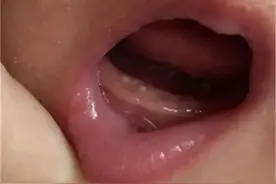 听孩她妈说马牙子要用黑布擦？可别信图片