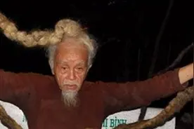 越南85岁老汉15岁起，不剪头也不洗头，头皮止痒全靠食用油涂抹图片