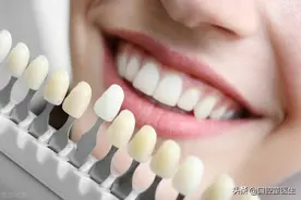 详细对比牙体修复中镍铬、钴铬、贵金属和全瓷牙冠的优缺点图片