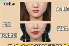 你早该清楚的！下颌歪斜、大小脸真的是由于错误的咬合关系导致？图片