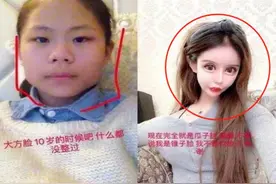 “网红失败整容照”大盘点，前后对比超惨烈，网友：根本没眼看图片