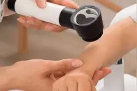 【健康小贴士】 酒精过敏的症状有哪些 酒精过敏怎么治疗图片
