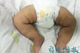 福建古田一宝宝发热后四肢冰凉！家长一个错误观念痛失幼子图片