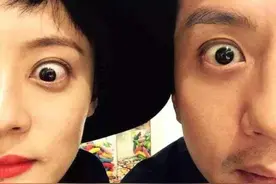 “热玛吉”让时光逆流，25岁开始你就应该开始“热玛吉冻龄”了图片