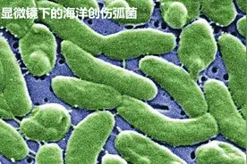 海鲜处理不当或可致命，警惕这个来自海洋的无声杀手图片