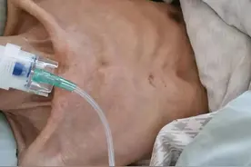 医生说，老年人为什么要尽可能减少长期平躺卧床？图片