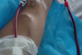 活着，再苦再难，我只想活下去图片