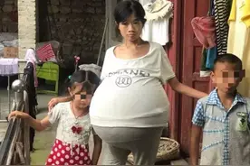 希望就在前方！社会各界献爱心，“巨肚妈妈”目前已入院治疗图片