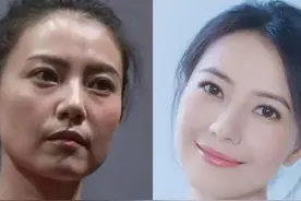 怎么拯救眼袋和暗沉肤质呢？图片