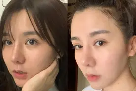 美白名品烟酰胺成分不能和什么混用，你知道吗？图片