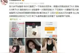 “网红女孩”13岁开始整容，经历了60次手术，如今成这模样图片
