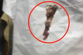 三岁女童全身恶臭洗不掉，妈妈带去医院检查，结果令人作呕图片