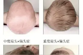 这六点不注意，爸妈基因再好孩子也会变丑图片