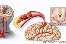 心脑同时被“梗”，一个决定后“倒霉大叔”竟然“逆袭”了……图片
