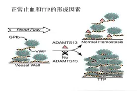 【爱心接力】众志成城！南大一附院血液科成功救治罕见TTP患者！图片