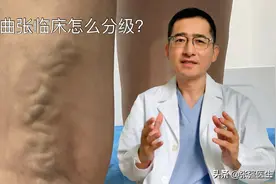 自我对照一下，你的静脉曲张属于哪一期？图片