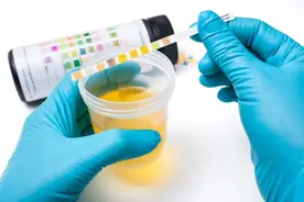 肾功能受损有哪些征兆？提醒：除了泡沫尿，这6种症状也别大意图片