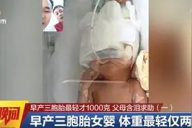 ​三个一个都不能少！早产三胞胎最轻才2斤，一出生就被送进保温箱，父母含泪求助图片