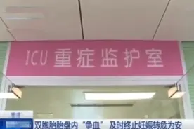 天生冤家！孕妈肚子里，双胞胎妹妹被姐姐强行吸血，医生巧妙劝和图片