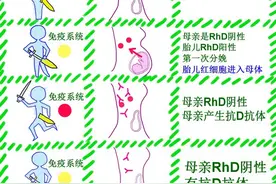 母胎RH（熊猫血）血型不合溶血病全攻略图片
