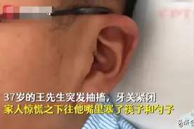 癫痫抽搐是什么样的？什么原因导致的呢？我们需要如何来注意呢？图片