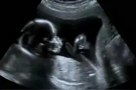 【妇幼微科普】医生！我想做“四维彩超”图片