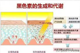 激光危险大，保健品不靠谱！最实用祛斑方法，只靠护肤品就可以图片