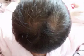 头顶一个旋和两个旋的孩子有何区别？科学解释来了，家长别无知图片