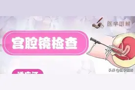 医学图解——宫腔镜检查、手术，有哪些适应症？（科普）图片