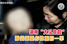 6岁幼童感冒，头围一夜增长6厘米，脑袋是正常小孩的3倍图片