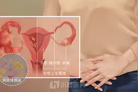盆腔炎下腹疼痛发生在哪里？图片