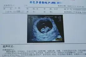 我整个孕检碰到的一些问题给孕妈们整理一下图片