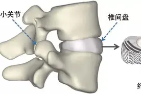 一文讲透腰椎运动力学特征与相关疾病关系图片