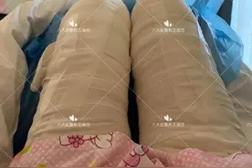 案例分享｜大腿环吸图片