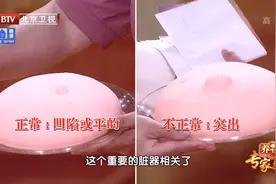 肚脐长这样，可能暗示肝脏出了问题！辨清四个迷惑性症状图片