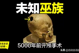 《山海经》未知巫族：5000年前开颅手术，一直隐藏在我们身边图片