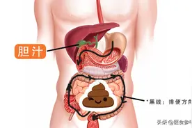 为什么大便完要回头看？这5种大便，一定要当心图片
