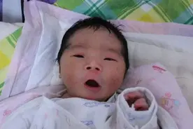 “好丑！生了一个小毛孩”，如何处理新生儿胎毛胎脂？有必要学学图片