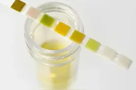 哪些食物和药物会引起小便颜色改变？图片