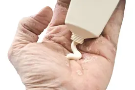 总觉腿上生了虫每天洗澡却越来越痒，老先生也需要涂涂抹抹了图片