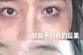 闷逗、长闭口？那是你的卸妆油用错了，油敏肌的卸妆挚爱好物图片