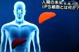 缺胳膊少腿可以长复原图片