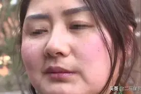 女子在居民楼内做“医美”，注射除皱针后，脸歪了...图片