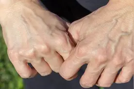为什么有的人手背上的青筋那么明显？视频封面